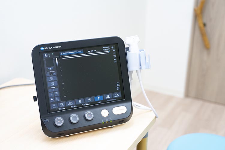 超音波診断装置